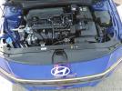 Hyundai ELANTRA Se Image 5